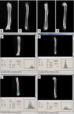 Supplement With Calcium or Alendronate Suppresses Osteopenia Due to Long Term Rabeprazole Treatment in Female Mice: Influence on Bone TRAP and Osteopontin Levels